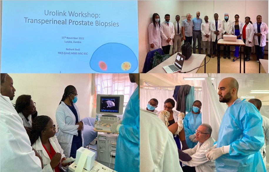 The first #Urolink #TP biopsy training course in #Lusaka, Zambia. @nishbedi facilitated the perfect way to start a new service at the University Teaching Hospital, a short talk on the technique, #simulation & then a real-life demonstration. @BAUSurology @SuzieVenn @COSECSA @BXTA