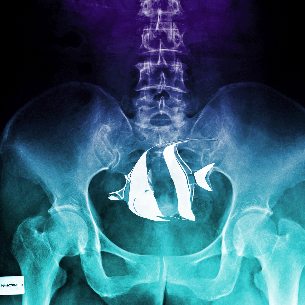 Hi Guys!
Have any of you seen my fish? It’s a tropical fish🐠, very beautiful 🖤,
I found it inside a plastic bag floating in Sydney Harbour.

#nft #NFTCommunity #NFTshilling #BNB #BSCGemsAlert #apr #NFTutility