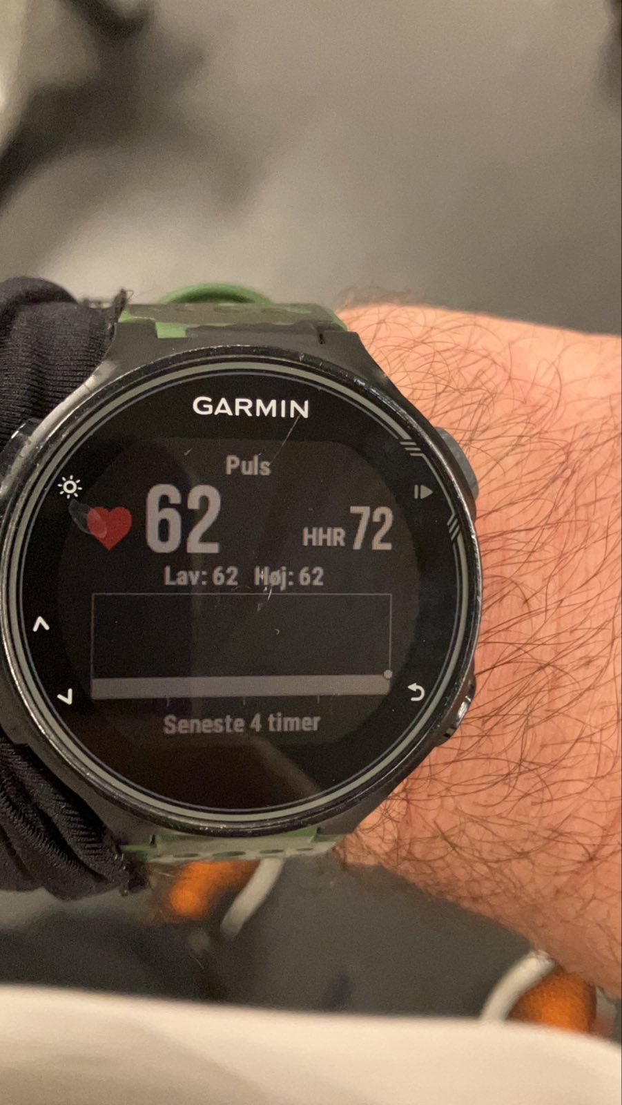 gør ikke halvø præsentation Garmin on Twitter: "@TNKYMNKY I'd be happy to answer any questions or  concerns you have about your Garmin watch! Please send us a direct message  with the following information. - Serial number