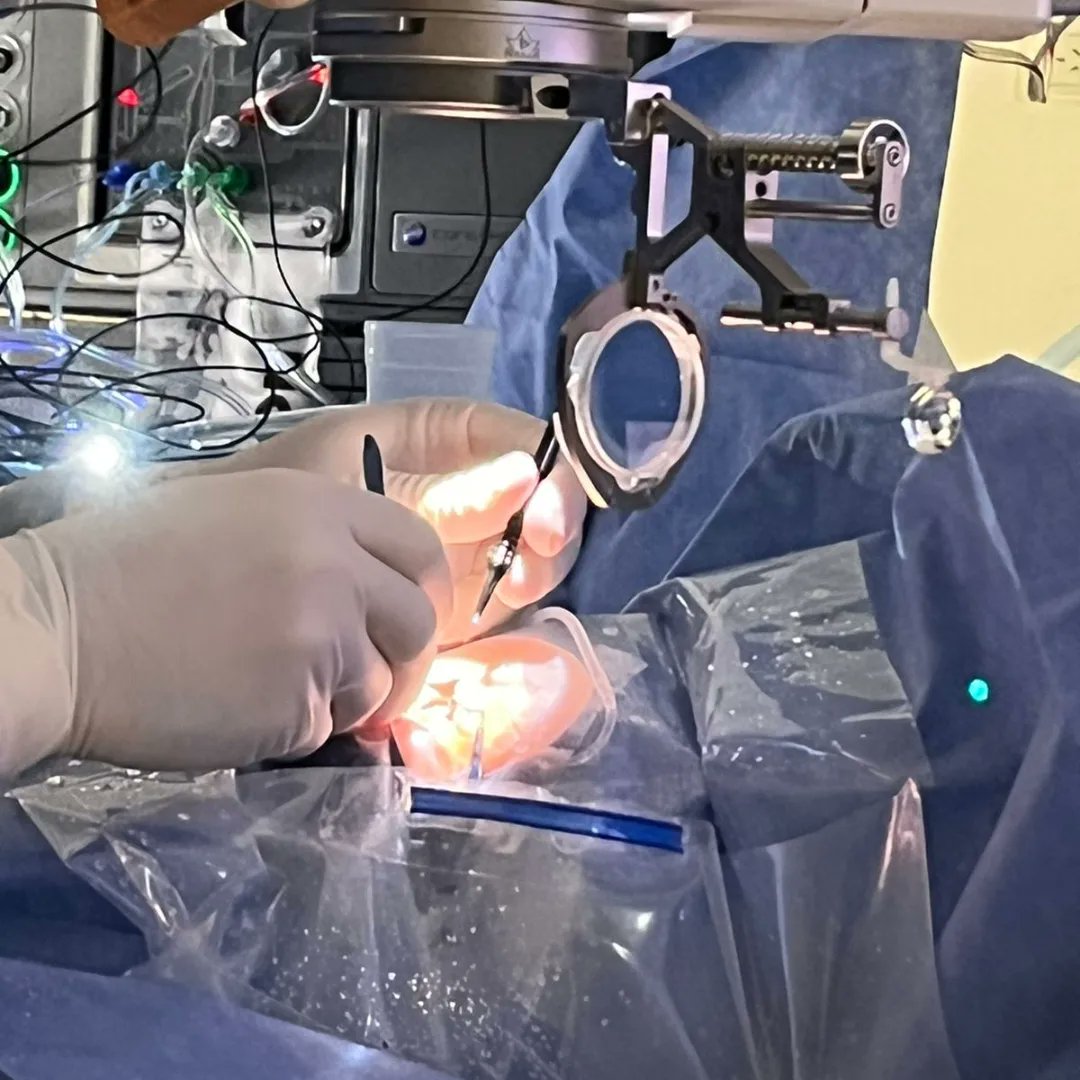 BrasilOculus's tweet photo. Um pouco mais sobre o dia de cirurgias ao vivo durante o Congresso Panamericano de Retina e Vítreo em Buenos Aires com o BIOM® 5.
#Biom #GrandeAngular #Macula #Retina #Vitreo #Vitrectomia #Oftalmo #Oftalmologia #Oftalmologista #proveo8 #oculusbrasil #SPRV #BIOM5 https://t.co/xuatIGzwbu