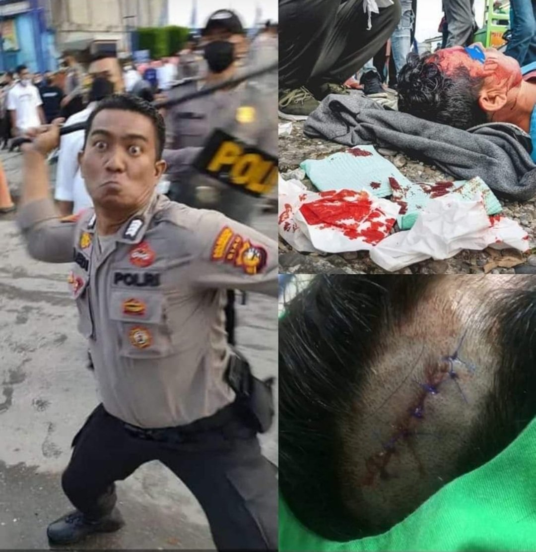 MSULTANI160's tweet photo. In Afghanistan massacred by Taliban. Their properties confiscated. When they fleeing to safer place to escape persecutions, they end up brutally beaten to death.
Indonesian police brutally beaten a Hazara. Very Shameful!
#StopHazaraGenocide https://t.co/o6Q9dKxnMr