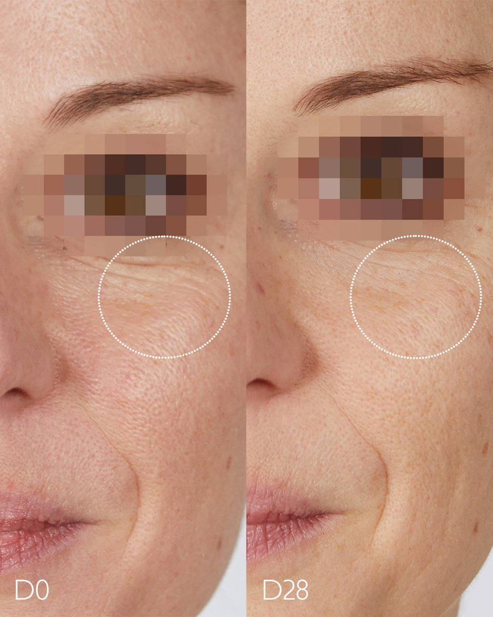 Looking for an effective alternative to retinol? Our Resveratrol-Lift collection is just what you need! It’s 2x more effective than retinol to firm the skin 💪

*Real, unretouched results using The Instant Firming Serum and Firming Cashmere Cream for 30 days.