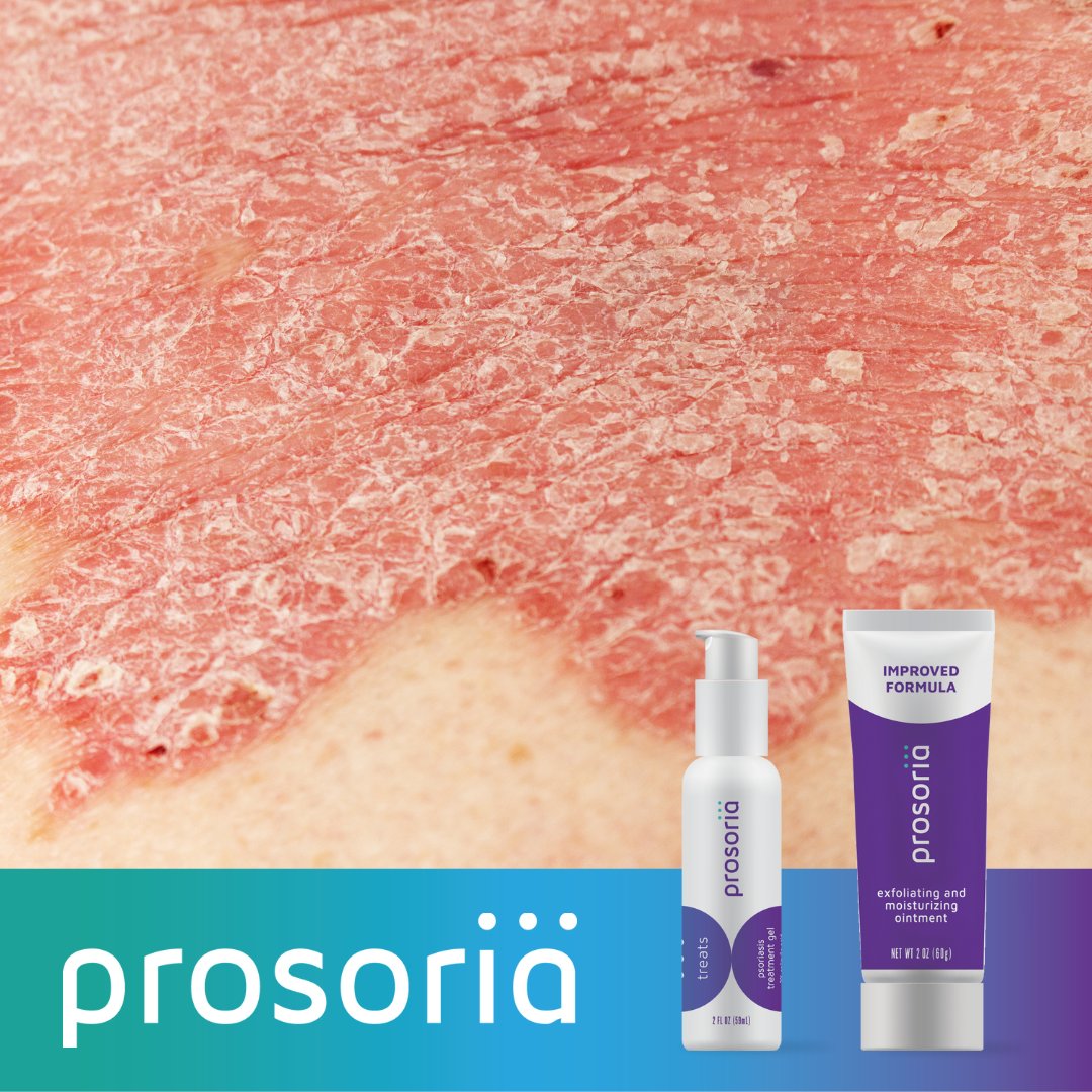 Prosoria tweet media