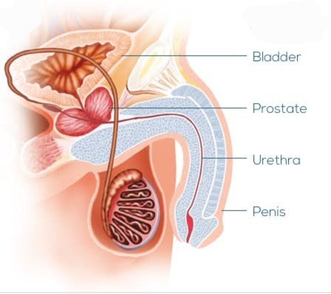 Bismillaah
Karena ada pertanyaan di inbox. Maka sy jawab dlm thread.

"Ketika air kencing terasa kel...