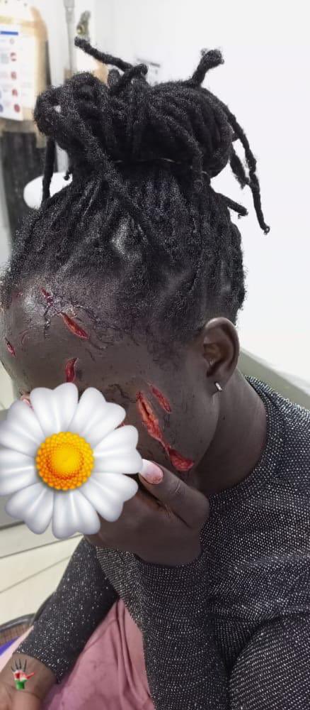 This lady was attacked yesterday morning at 11:00am on her way to University of Nairobi just because she was carrying a laptop.  These attacks are getting out of control. Where are <a href="/DCI_Kenya/">DCI KENYA</a> <a href="/NPSC_KE/">National Police Service Commission - Kenya</a> <a href="/InteriorKE/">Ministry of Interior | Kenya</a> please <a href="/StateHouseKenya/">State House Kenya</a> do something. Please.