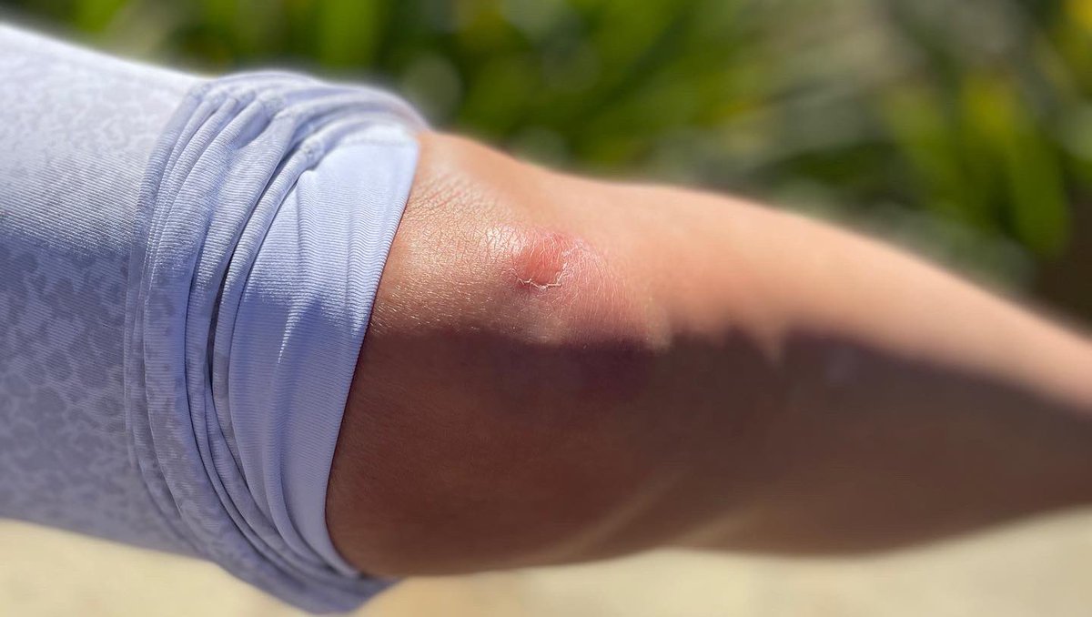 thebikinichef's tweet photo. Me doing a full on faceplant this morning on my walk. #faceplant #bumknee #ouch #owie #phonesafe #walkinghazards #morningwalk #fitness #beautifulmorning #trippedovernothing 🤦♀️ https://t.co/jGy7Q6schq