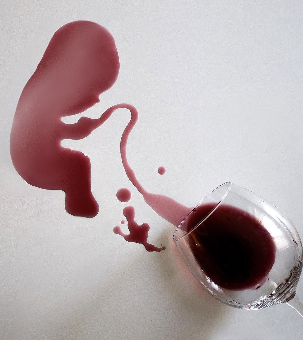medfetalBCN's tweet photo. En el embarazo, el consumo de alcohol perjudica el crecimiento fetal, afecta el neurodesarrollo e incrementa el riesgo de enfermedades en la edad adulta. Hoy #DíaMundialSinAlcohol, toca recordarlo: en el embarazo, ¡ni un sorbo! https://t.co/mAsFIrzRhw