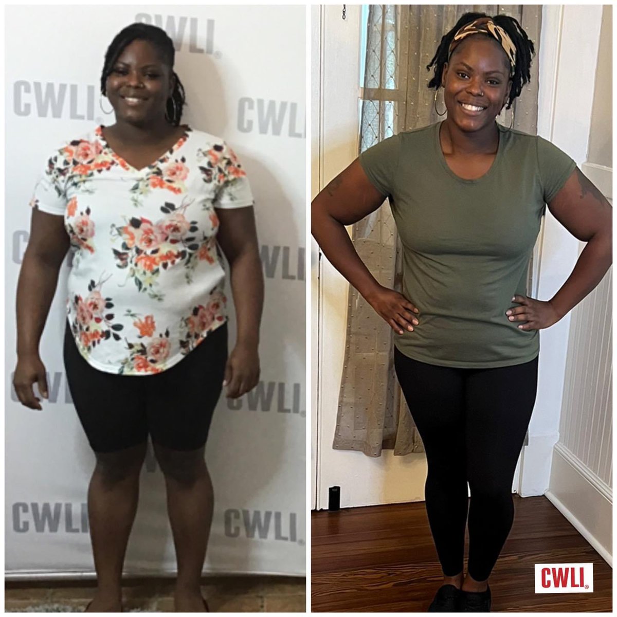 DrEddyClinic's tweet photo. RT @C_W_L_I: 37 lbs GONE☑️
3 months maintenance☑️
We are so proud to follow up with Chantrell at her 3 months follow up and report beautiful maintenance.
~~~
Schedule a free consultation: call or text 704-271-9757. #cwli #functionalmedicine #weightloss #… https://t.co/Xbkh0MT1e8