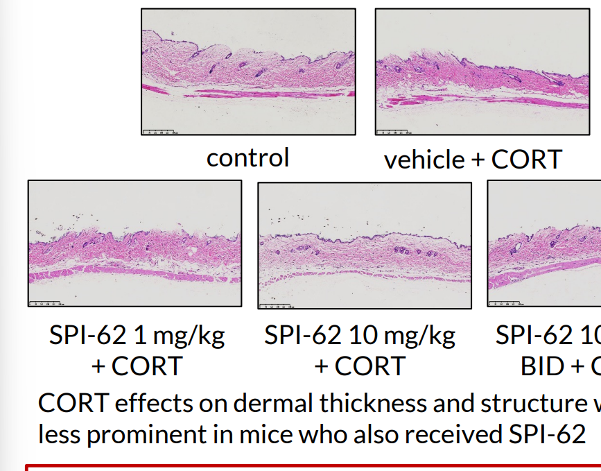 David Liew (@drdavidliew) on Twitter photo Super interesting: safer steroids?
Molecule (SPI-62) being trialled in PMR pts now (n=48)
In mice, normalizes glucocorticosteroid toxicty:
- didn't put on weight
- skin didn't thin
For PMR pts stuck on PNL for months, very enticing. Watch this space!
ABST1549 #ACR22 <a href="/RheumNow/">Dr. John Cush</a> Super interesting: safer steroids?
Molecule (SPI-62) being trialled in PMR pts now (n=48)
In mice, normalizes glucocorticosteroid toxicty:
- didn't put on weight
- skin didn't thin
For PMR pts stuck on PNL for months, very enticing. Watch this space!
ABST1549 #ACR22 <a href="/RheumNow/">Dr. John Cush</a>