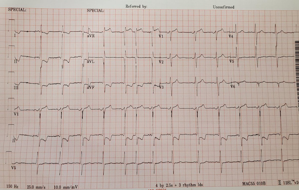 EM Board bombs tweet media