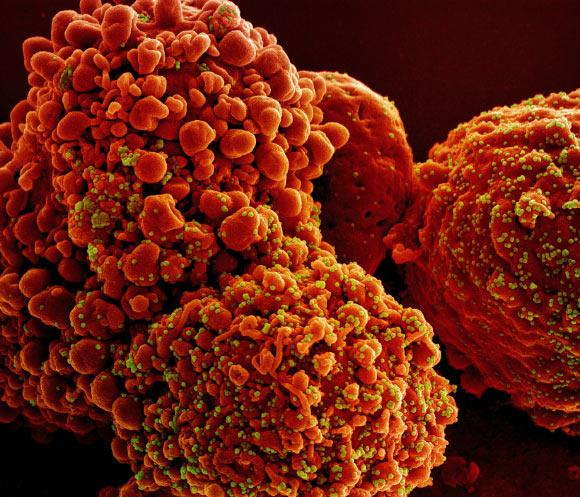 Adv_MedScience's tweet photo. 📢#Research
The global spread of the severe acute #respiratory #syndrome #coronavirus 2 (SARS-CoV-2) has called for an urgent need for the identification of compounds able to control, prevent or slow down the global #pandemic. 

#AMDHS #Publication #Journal #MedicalJournal #COVID https://t.co/2oIwylcjQB
