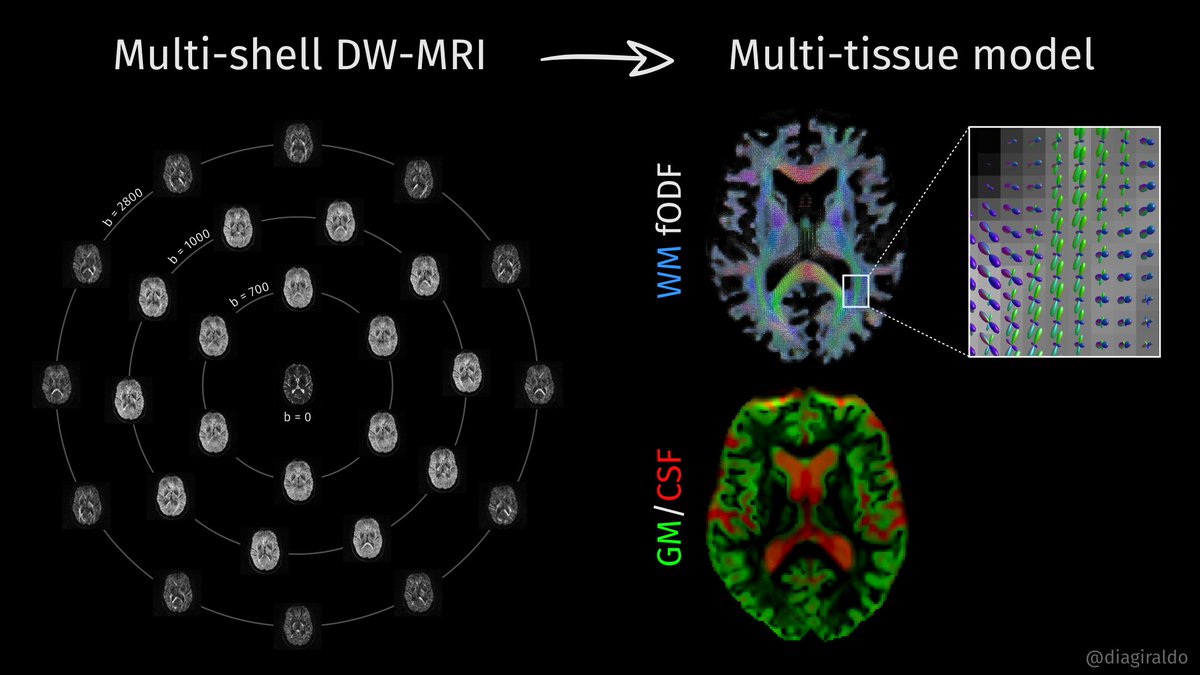 diagiraldo's tweet photo. We are 🙌super-glad🙌 to share our latest paper published in the @journal_ad

🧠It is a comprehensive analysis of brain differences in #AlzheimersDisease patients by looking at micro- and macroscopic properties using multi-shell #DiffusionMRI
 
https://t.co/grWjWcgeGj https://t.co/aXPjhy1RUC