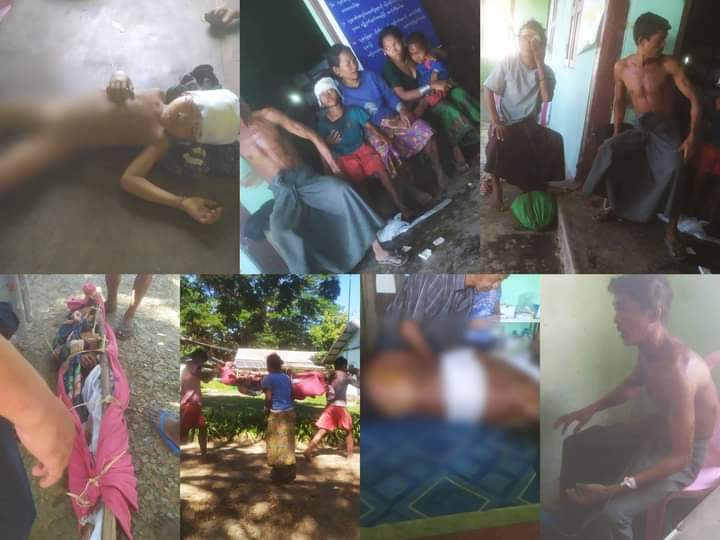 pzl_jourlm's tweet photo. BREAKING : Eleven civilians including children were barbarically massacred and thirty more ones got injuried by heavy artilleries violently shelled targeting to  earrings-net show by Battalion-7 Army Base in Gyo Chaung village, #Rakhine’s Maung Taw town today. #WarCrimesOfJunta https://t.co/EhM9OwTaEe