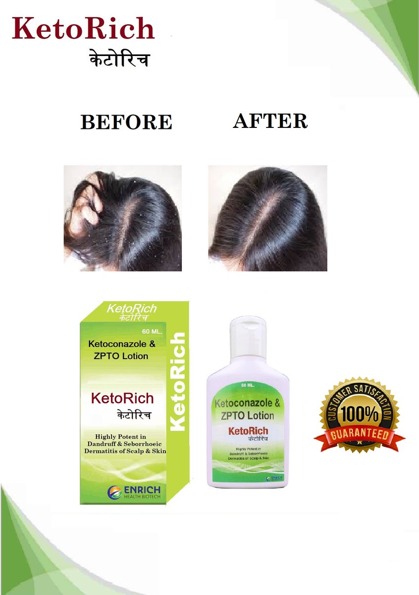 enrich_biotech's tweet photo. KetoRich Lotion
It treats different types of #fungal infections including: #athlete's #foot. #jock #itch, an infection in the groin area. #sweatrash (#intertrigo), a #rash that usually appears in #folds of #skin.
#Ketorichlotion #Ketorich #lotion #dandruffremoval https://t.co/zJO1nI8ZnS