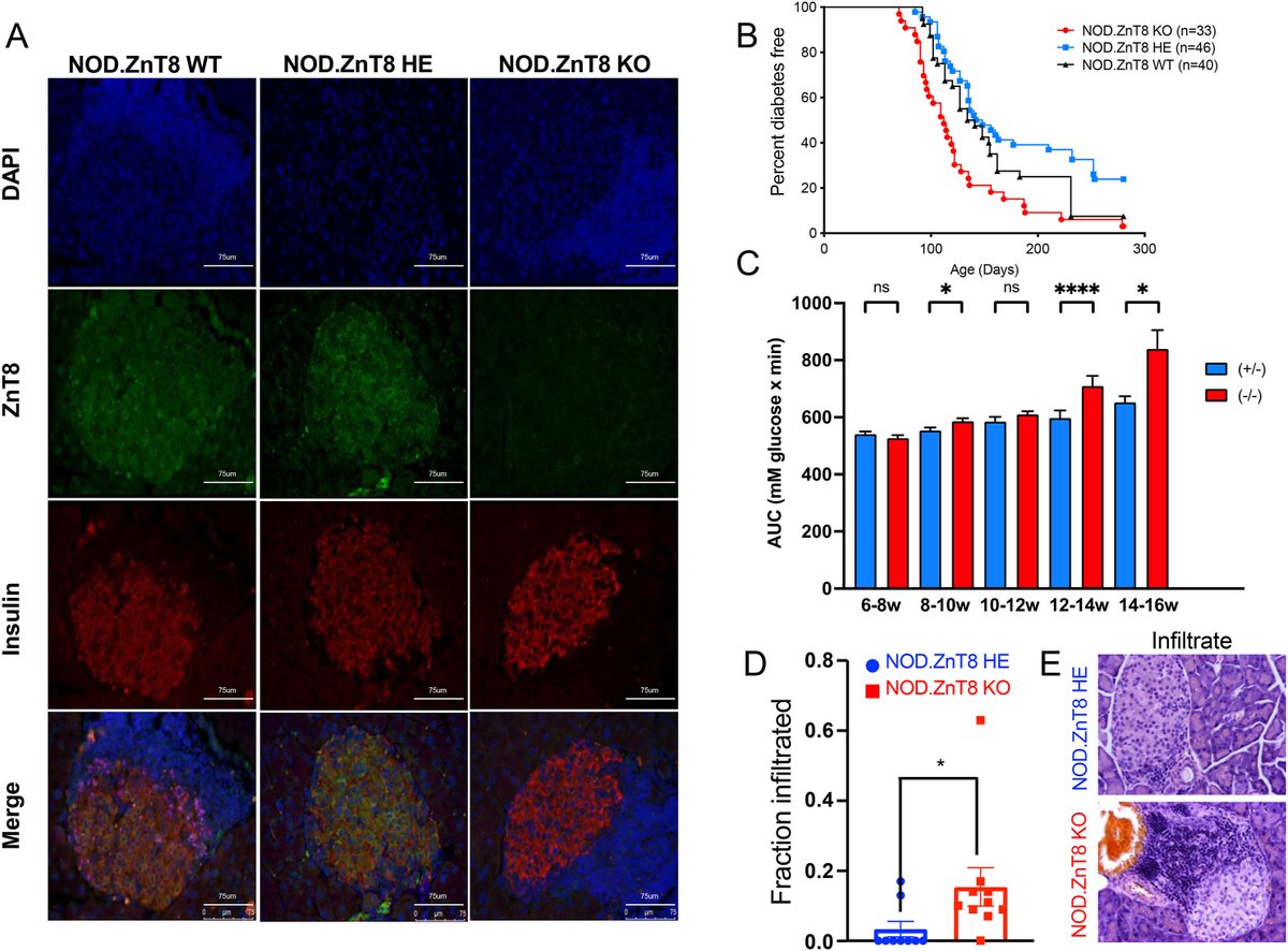 MolMetab's tweet photo. The Davidson lab at the University of Colorado show that #heterozygosity for the #Zinc transporter 8 gene was partially protective against #T1D.
👩🔬👨🔬@CUSystem @CUAnschutz
➡️https://t.co/H3imNMn0GC https://t.co/Ur9hOZiQ4T