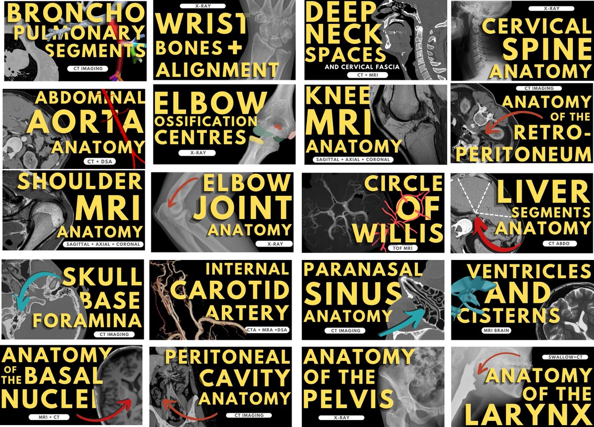 20 radiology videos now posted on <a href="/YouTube/">YouTube</a>. New video drops tomorrow - one slide from each video with five questions. The result a 100 question practice anatomy test. Great way to find out the gaps in your knowledge before your part 1 exam #radres #radiology