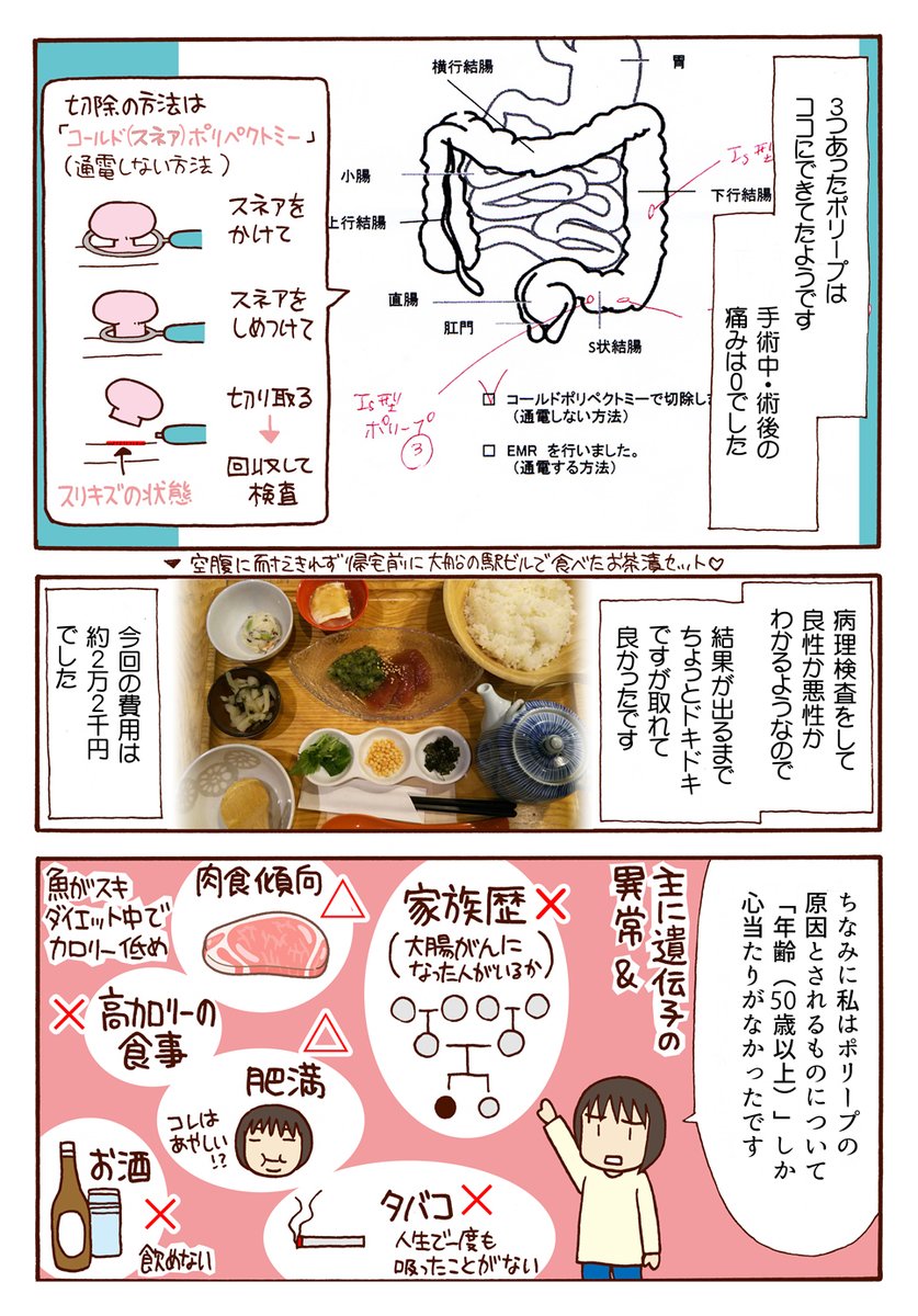 2/2
#大腸内視鏡検査 #ポリープ 