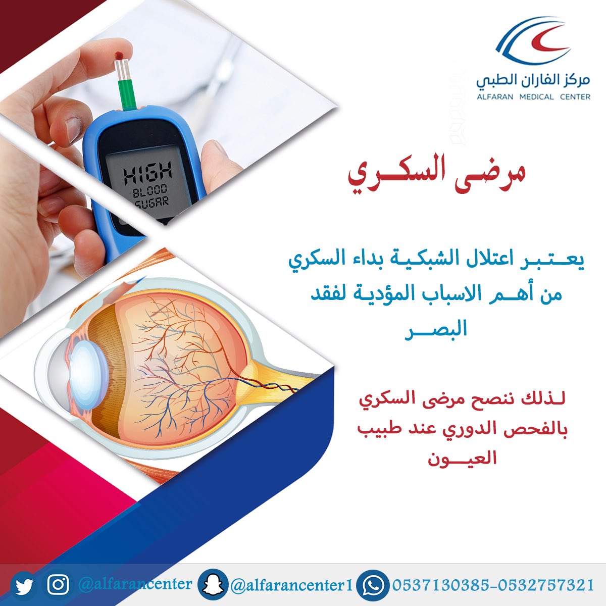 alfarancenter's tweet photo. من اهم اسباب فقد البصر قد يكون بسبب #اعتلال_الشبكية بسبب داء #السكري 
لذلك ننصح مرضى السكري بالفحص الدوري عند طبيب العيون  

#نصيحة_الفاران 
صحتكم تهمنا 🌹🌹🌹

للاستفسارات وحجز المواعيد : 
0537130385📱
0114565153☎️

#الرياض #طبيب_عيون https://t.co/0tmNJ3EZOh