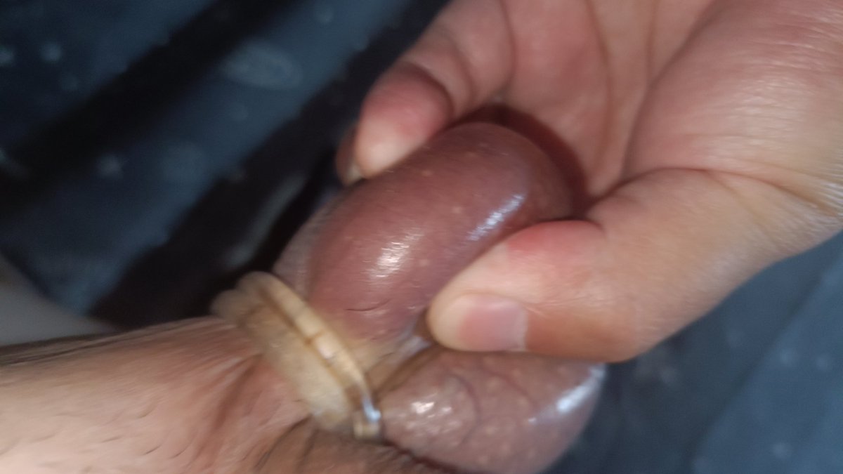 handsherm's tweet photo. #虐蛋 #踩蛋 #穿刺 #阉割 #踢蛋 #榨精调教 #精牛 #睾丸  #CBT #睾丸穿刺 #球 #爆蛋  #SM #性瘾  喜欢么，大卵蛋被拽得快要捏爆的样子，用力捏爆开它，来吧 https://t.co/ma9CxKyUom