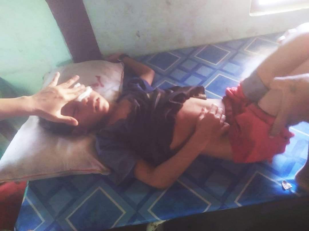 Today's situation in Rakhine District is so bad that the Myanmar Army will take the most decisive action.