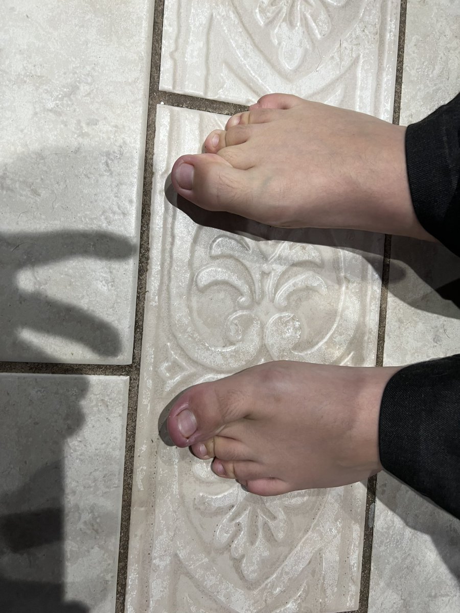 Just found out my son can cross his toes…. Is this a thing or is he just weird 🤣🤣🤣