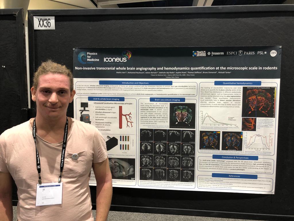 mathis_vert's tweet photo. Come and see my poster this afternoon to discover the super-resolved microvasculature of the brain #ultrasound #ULM 🐀🧠〰️ https://t.co/FlIQ0FMYFM