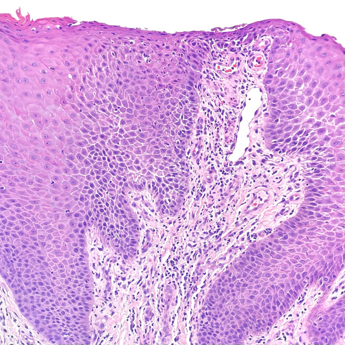 Michael Feely, DO tweet media