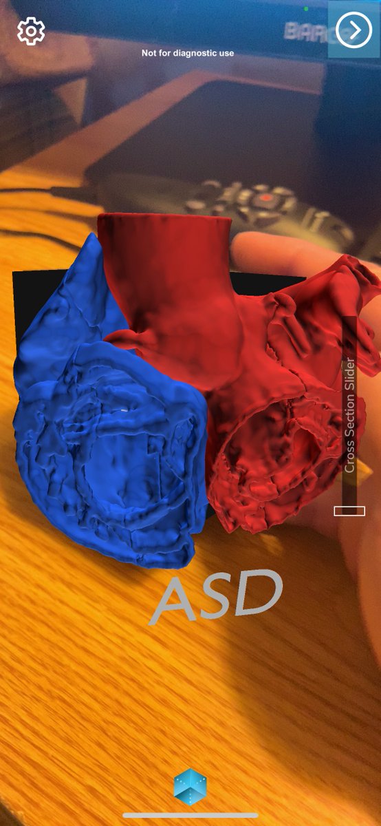 Sira Medical (@siramedical) on Twitter photo We had a great time demo-ing our work in #AugmentedReality #MedEd at #AAMC22 in Nashville! Great to meet so many excellent educators and leaders in this space! <a href="/RickBeberman/">Rick Beberman</a> <a href="/JesseCourtier/">Jesse Courtier, MD</a> We had a great time demo-ing our work in #AugmentedReality #MedEd at #AAMC22 in Nashville! Great to meet so many excellent educators and leaders in this space! <a href="/RickBeberman/">Rick Beberman</a> <a href="/JesseCourtier/">Jesse Courtier, MD</a>