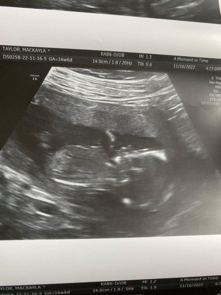 MackaylaHoward's tweet photo. Our sweet •girl• 
you are already so loved!

Memphis Marie Taylor 💕 https://t.co/HjI1oI5Hv1