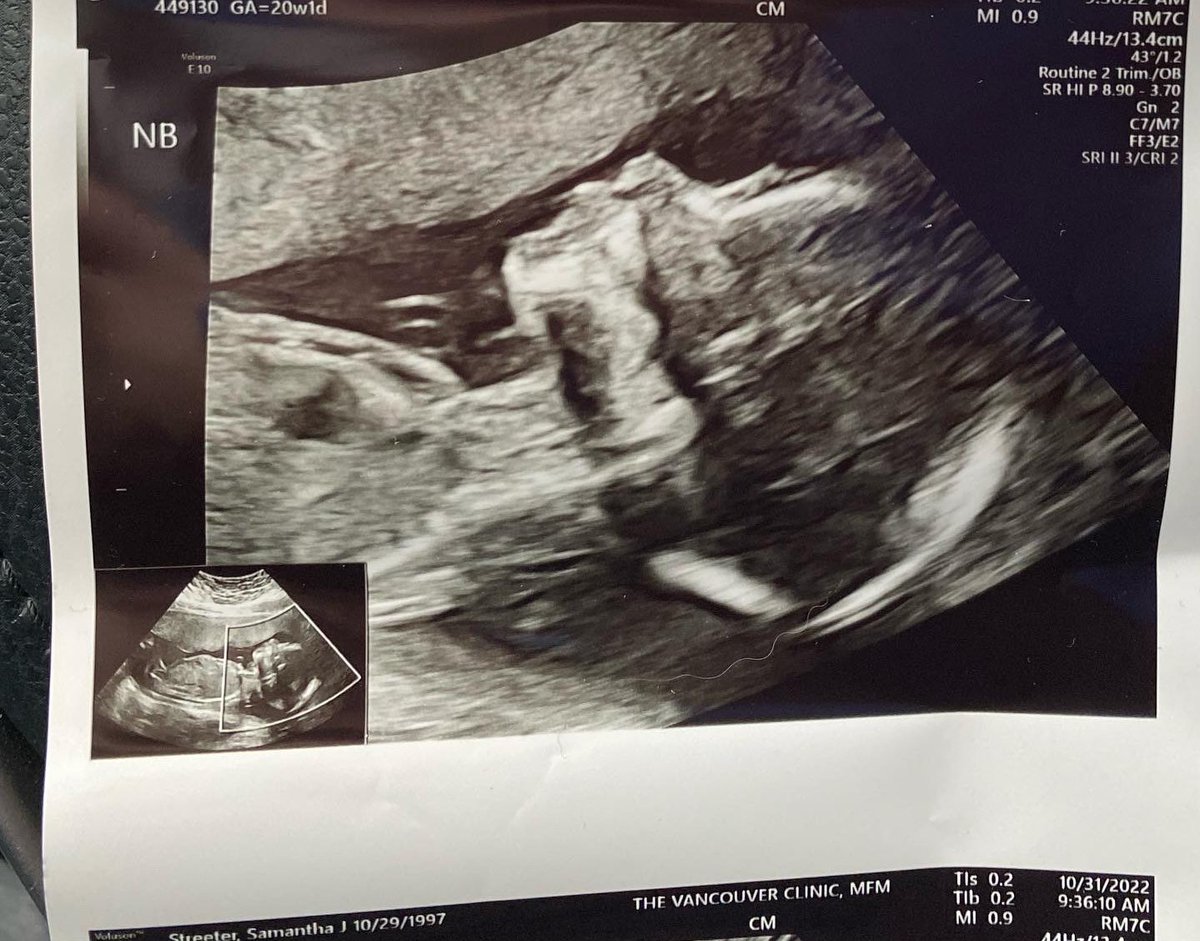 SammyStreetz's tweet photo. I can’t believe I’m already 5 months pregnant and we’re halfway there to meeting our baby girl. 🥹❤️ Life is crazy, time flies!! @mason_perry15 https://t.co/GQi5WWX1mi