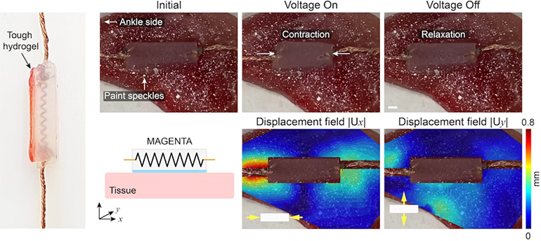 Implantable Device Adheres to Muscle, Treats Atrophy

Scientists at the Wyss Institute for Biologically Inspired Engineering at Harvard have developed a mechanically active gel-elastomer-nitinol tissue adhesive, otherwise known as MAGENTA. The impla…
medgadget.com/?p=1542067&utm…