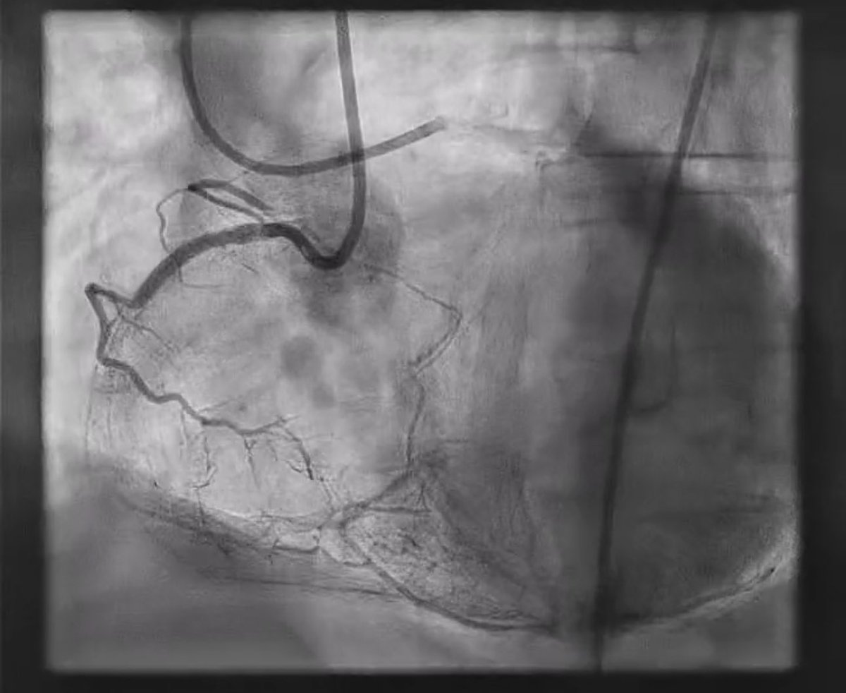 Erik Rafflenbeul (@kardiologiehh) on Twitter photo 🚨Heute…LIVE…In Hamburg🚨
#CardioSlam - Das Hamburger Original
Toller Case von Dr Fabian Gocht ( <a href="/FabianGocht/">Fabian Gocht</a>)
📆 17.11.22, 18 Uhr
🌆 East Hotel Hamburg 🚨Heute…LIVE…In Hamburg🚨
#CardioSlam - Das Hamburger Original
Toller Case von Dr Fabian Gocht ( <a href="/FabianGocht/">Fabian Gocht</a>)
📆 17.11.22, 18 Uhr
🌆 East Hotel Hamburg