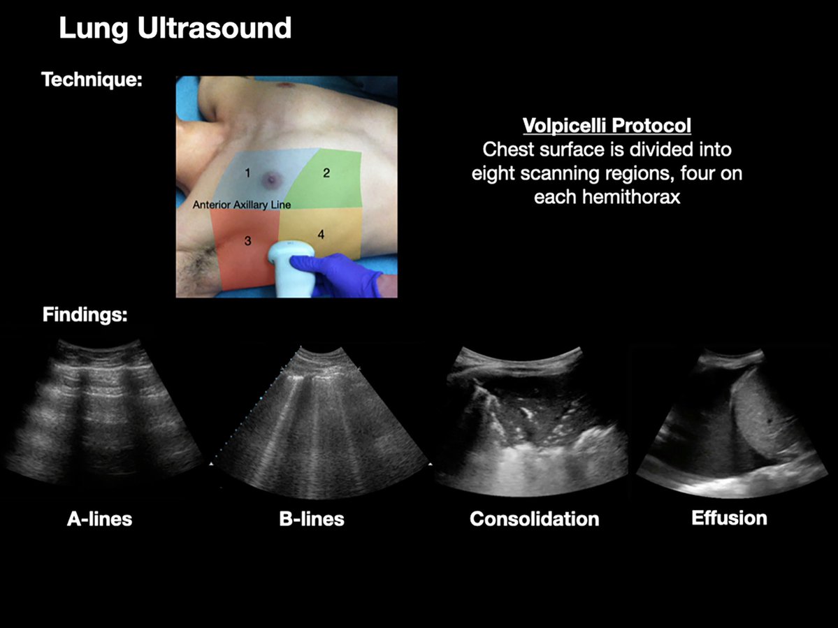 NephroPOCUS tweet media