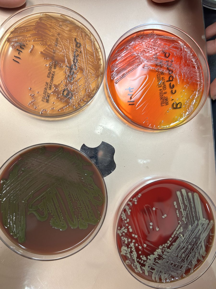 WayneStateID's tweet photo. @WayneStateID #Micro rounds teaching by our APD, Dr Lea Monday for the fellows.
Hands-on Oxidase @DocSaadia.
Identifying non-fermenters based on clinical scenario and culture plates to help strengthen micro for #IDboards
#Burkholderia on blood,choc,Mac and BCA agar
#IDTwitter https://t.co/pzahoW0qI7