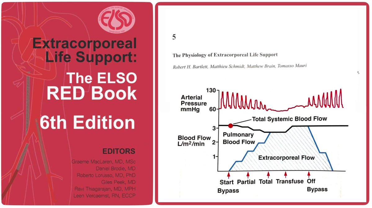 EcmoGarrahan's tweet photo. La fisiología del #ECLS
📕 fisiología cardiopulmonar
📕 fisiopatología durante #ECMO #ECCO2r
📕el circuito ECLS
📕modos de acceso vascular
📕 eliminación de CO2
📕 Manejo de ECLS
Lea todo en el capítulo 5 de la 6ª del Libro Rojo de ELSO.
🛒 📕📕 https://t.co/kNEQ8khT9l https://t.co/0Uon36R01E