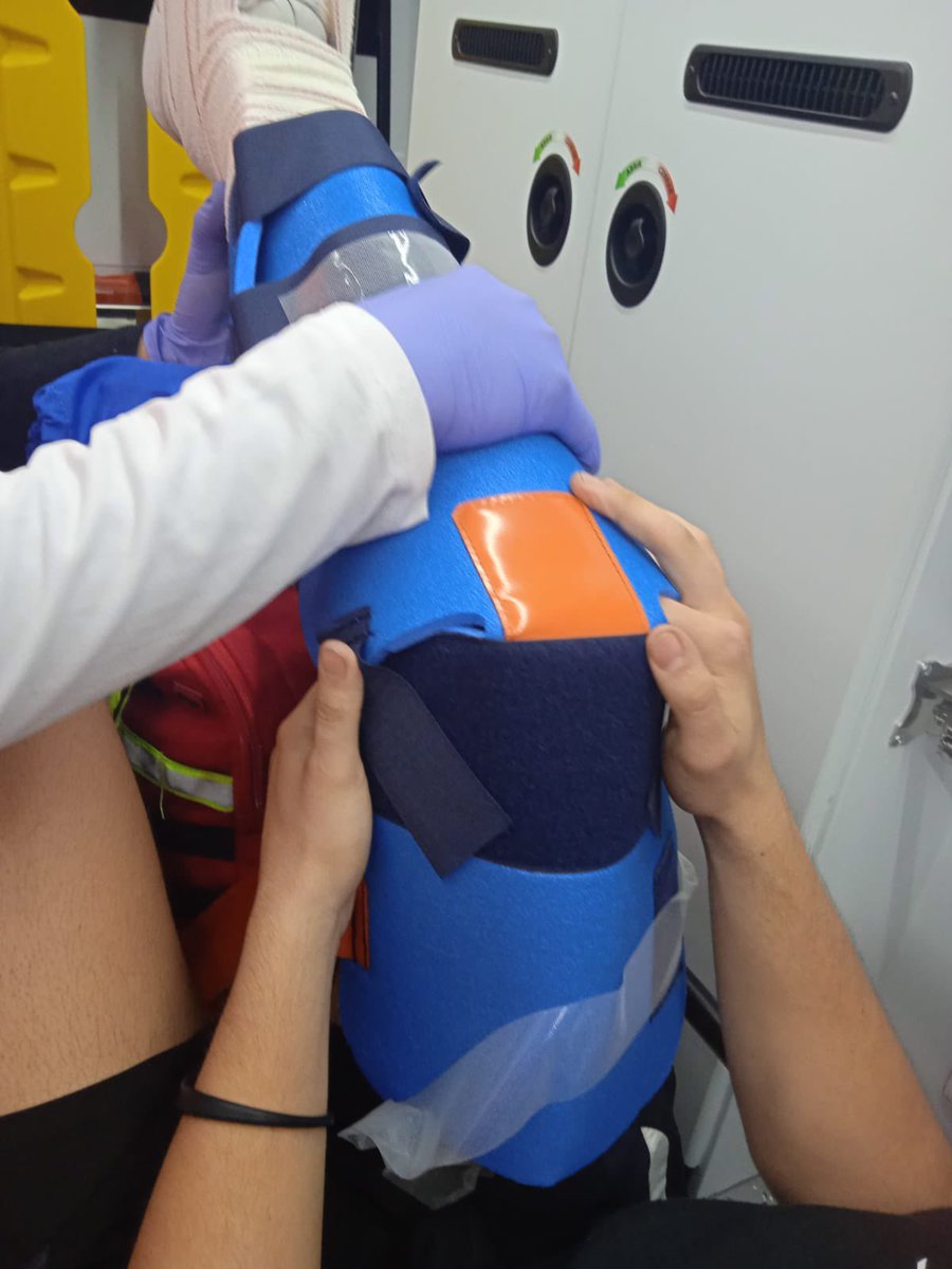 fernanditofnl's tweet photo. Ayer otro aviso de los que hay que usar la inventiva.
Luxación completa de rótula:
Dos férulas semirrígidas para mantener posición antiálgica, mochila debajo (mantener altura) y sujeción a barras de techo de la ambulancia (eso tras bajarlo en la evac+chair, que fue otro show) https://t.co/iG5PhV00L8