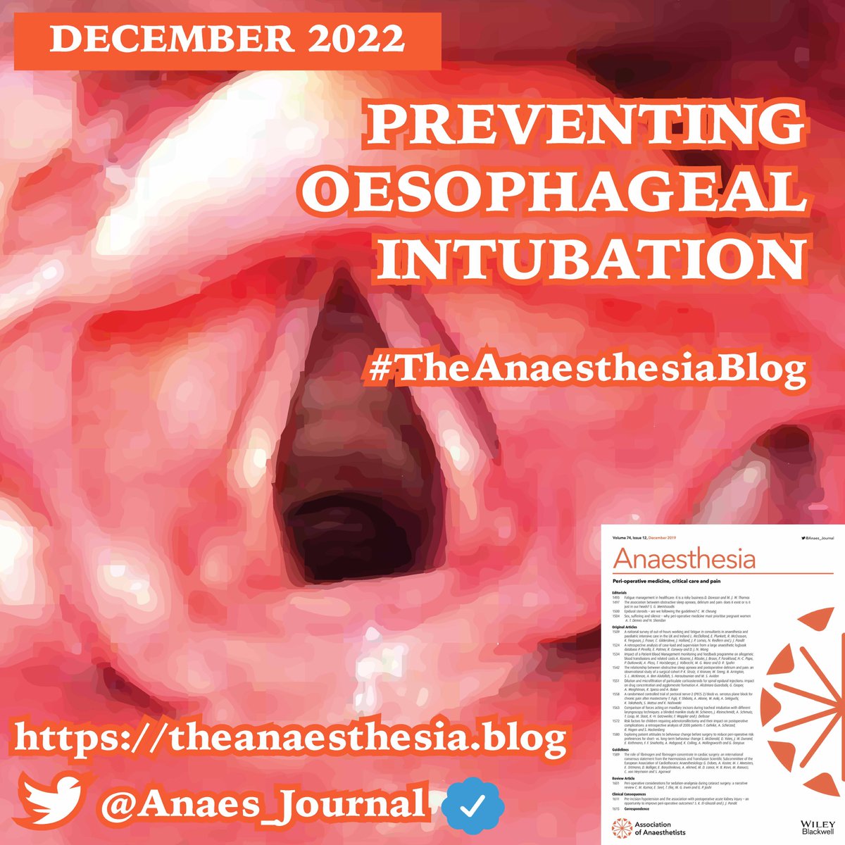 Anaes_Journal's tweet image. 🔐&quot;This new guideline is one of the most important papers from 2022. Oesophageal intubation during attempted tracheal intubation could happen to any one of us, yet traditional teachings and practice might lead to misdiagnosis.&quot;

#TheAnaesthesiaBlog

🔗theanaesthesia.blog/2022/11/17/pre…