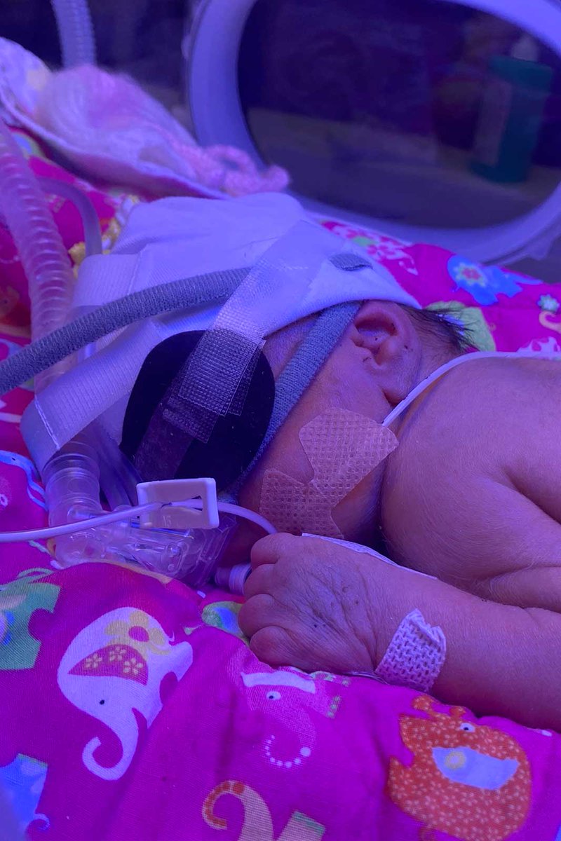 SSCBcharity's tweet image. On #WorldPrematurityDay we remember those babies #BornTooSoon. For many, today will be a happy day, but for others it may be a sad day, where loved ones are dearly missed. We look to the future &amp;amp; how we can improve the outcomes for our smallest &amp;amp; most fragile babies. 💜