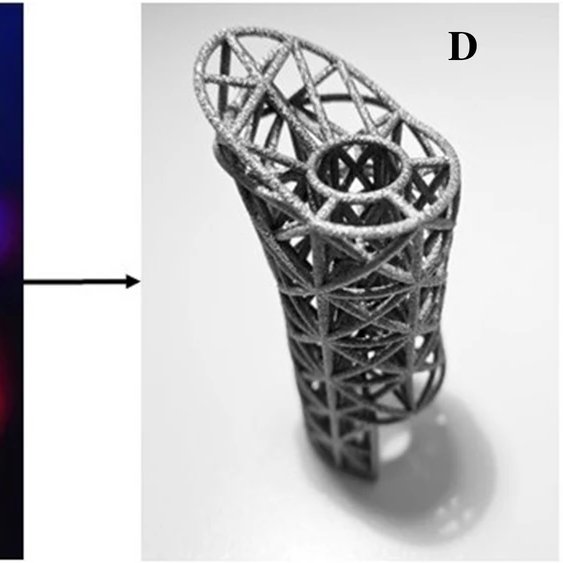 Orthopaedic Research Unit (@uct_oru) on Twitter photo Our latest publication is on #3Dprinted implants for lower limb defects in #LMICs.
#Congratulations to all the authors and the corresponding author <a href="/MaritzLaubscher/">Maritz Laubscher</a>
Read the publication here: doi.org/10.1007/s00590…
<a href="/UCT_Research/">UCT Research</a> <a href="/GlobalUct/">UCT Global Surgery</a> <a href="/DigitalUct/">UCT Digital Library</a> <a href="/uct_bmhsl/">Bongani Mayosi Health Sciences Library (BMHSL)</a> <a href="/UCTLibrary/">UCT Libraries</a> Our latest publication is on #3Dprinted implants for lower limb defects in #LMICs.
#Congratulations to all the authors and the corresponding author <a href="/MaritzLaubscher/">Maritz Laubscher</a>
Read the publication here: doi.org/10.1007/s00590…
<a href="/UCT_Research/">UCT Research</a> <a href="/GlobalUct/">UCT Global Surgery</a> <a href="/DigitalUct/">UCT Digital Library</a> <a href="/uct_bmhsl/">Bongani Mayosi Health Sciences Library (BMHSL)</a> <a href="/UCTLibrary/">UCT Libraries</a>