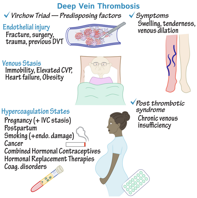 Studying Medicine on Twitter "Other signs of venous insufficiency
