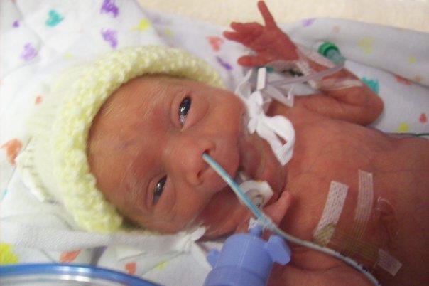 Angela Rayner (@angelarayner) on Twitter photo Today is #worldprematurityday & thanks to our wonderful NHS and โฆ<a href="/Blisscharity/">Bliss Baby Charity</a>โฉ support my Charlie born at 23 weeks & weighing just 455g is now a thriving 14 year old at mainstream school and doing more than ever could have been expected. โค๏ธ Today is #worldprematurityday & thanks to our wonderful NHS and โฆ<a href="/Blisscharity/">Bliss Baby Charity</a>โฉ support my Charlie born at 23 weeks & weighing just 455g is now a thriving 14 year old at mainstream school and doing more than ever could have been expected. โค๏ธ