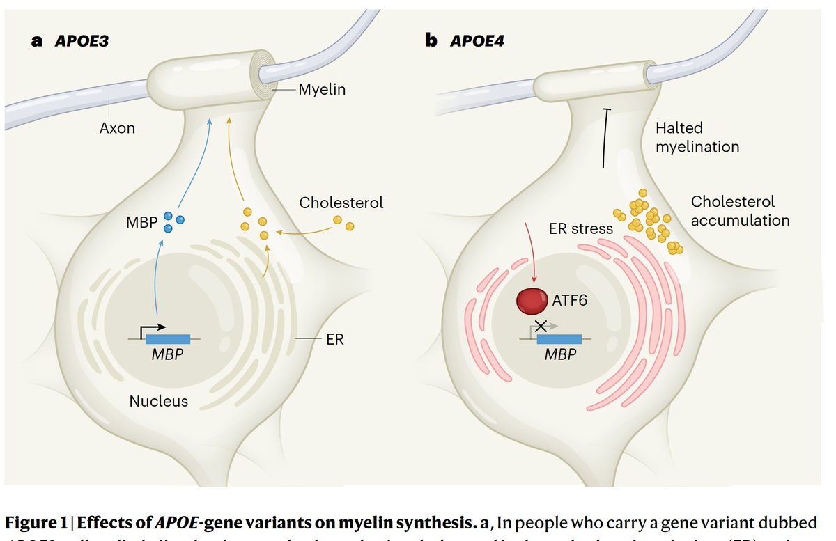 EricTopol's tweet image. About 1 in 5 of us have an APOE4 gene variant, the #1 genetic risk factor for Alzheimer&apos;s disease. But the mechanism for brain injury was a mystery, now getting unraveled (cholesterol processing by oligodendrocytes) nature.com/articles/s4158…
@nature
nature.com/articles/d4158…