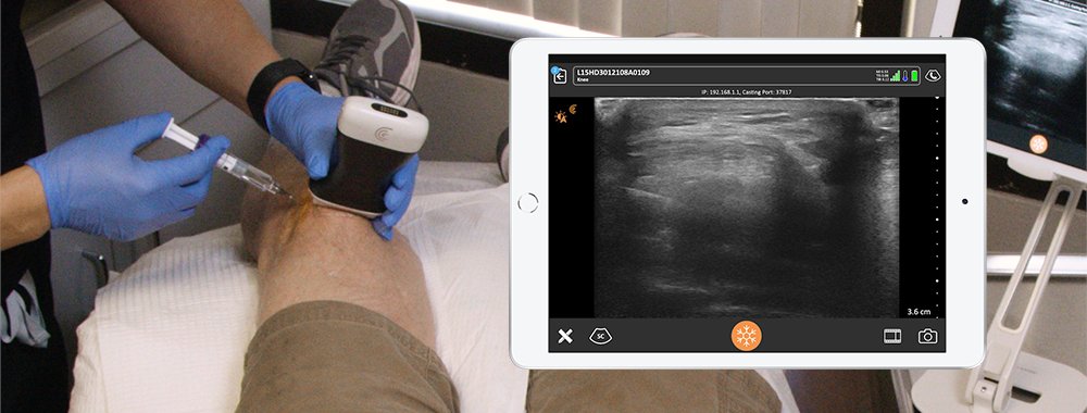 clariusmhealth's tweet photo. We're thrilled to exhibit at CAOM in Ottawa this week 🍁

Visit us at booth #5 November 18-19 and discover how you can diagnose injuries with confidence and ensure procedural safety with Clarius HD3 wireless ultrasound.

Learn more: https://t.co/Nk30YmPk6x https://t.co/D3NbUNKxhL