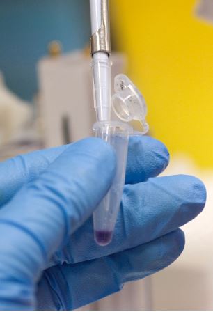 It’s all in the legs🦵well maybe not, but that is all <a href="/plantandfood/">Plant & Food Research</a> <a href="/Bugologists/">Insect Ecology NZ</a> need to gain valuable information about the #molecular makeup of spittlebugs collected as part of the <a href="/B3Director/">former B3 Director</a> project on potential #Xylella vectors in #NZ #entomology 🪲