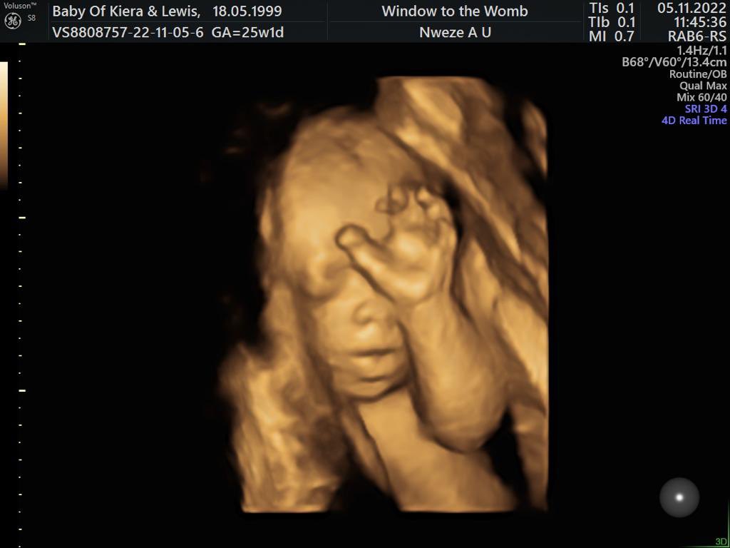 keereadss_'s tweet photo. The little love of my life 💖 12 weeks to go. https://t.co/Gfv4Js9GD7