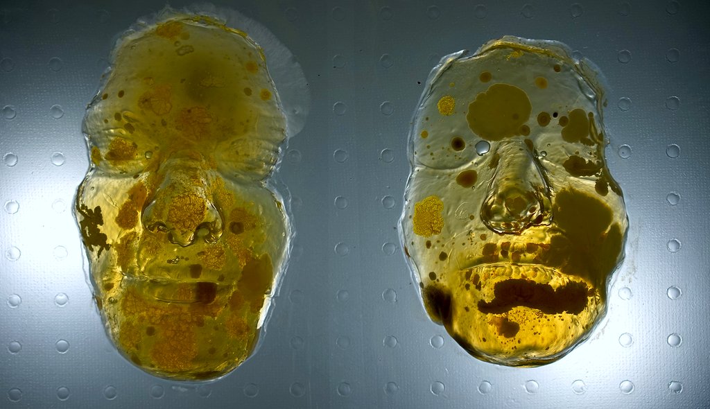 This "Microbial Portrait" was captured from a time-lapse after human faces were plated on growth media. The result is a snapshot of a home. A home to the millions of microorganisms called the skin microbiota.