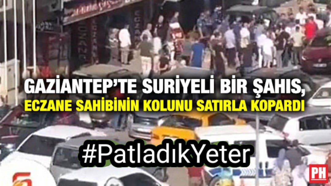 Ülkesine bu rezilliği bu kötülüğü yapanlara
Bu imkan ve imtiyazmı sunup sonrada vatanı kurtardığını sananlar yüzünden ülkece #PatladıkYeter