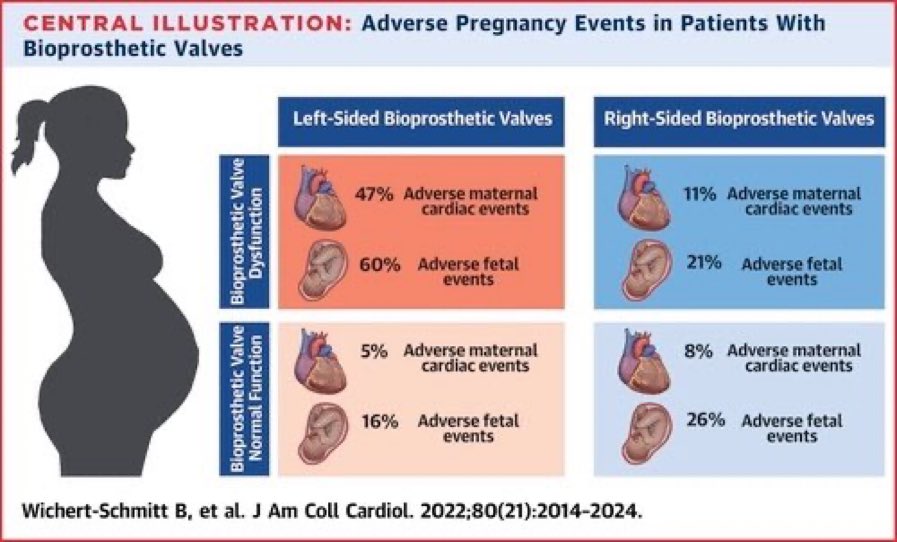 Dear paeds cardiologists…don’t forget to discuss pregnancy in adolescent females with valvular ❤️ disease. Proud to have worked with @Barbara67195667 &amp; <a href="/CandiceSilvers1/">Candice Silversides</a> to provide important data to help with decision making. #CardioObstetrics #JACC jacc.org/doi/abs/10.101…
