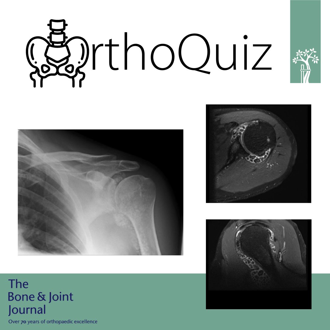 The Bone & Joint Journal tweet media