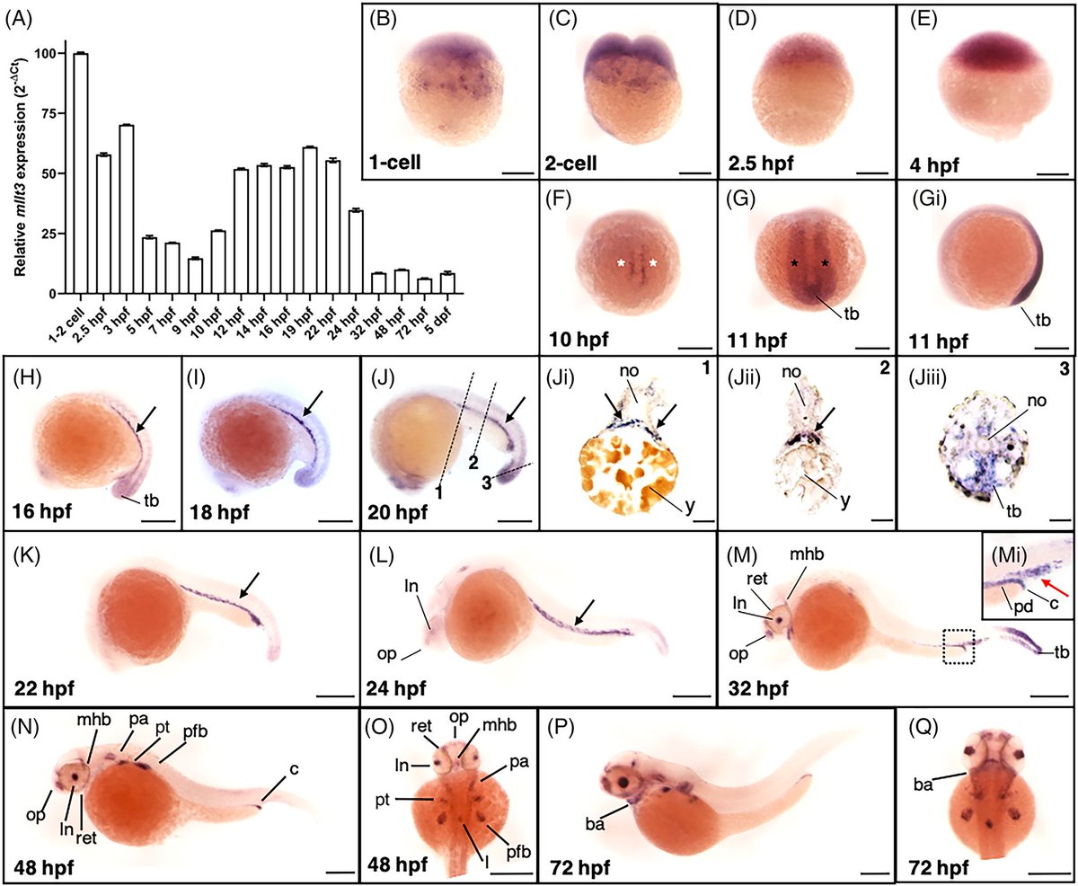 DevelopmentalDy's tweet photo. #Erythropoiesis is the process of making red blood cells, which when disrupted can lead to #anemia. Learn how the Leukemia-associated transcription factor #mllt3 is important for primitive #erythroid development during #zebrafish embryogenesis https://t.co/EygGjC6Wha https://t.co/3m59y0AEoR